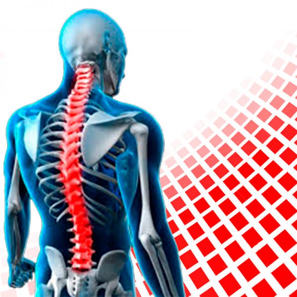 Sistema de Fixação Pedicular – Mini-Osteo