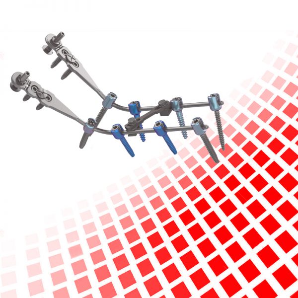Sistema de Fixação Occipitocervical