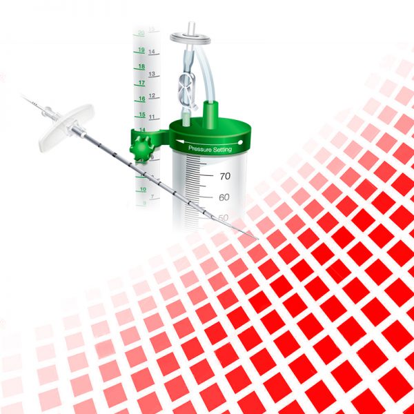 Derivação lombar externa