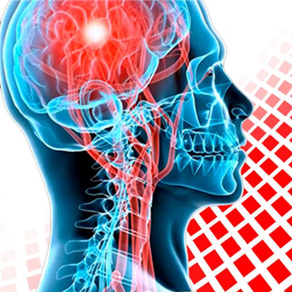 neurocirugia-categoria