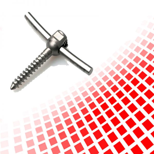 Sistema de Fixação Pedicular GS Medical